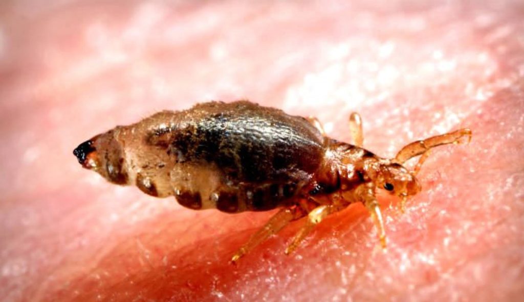 Even Head Lice Have New Year’s Resolutions