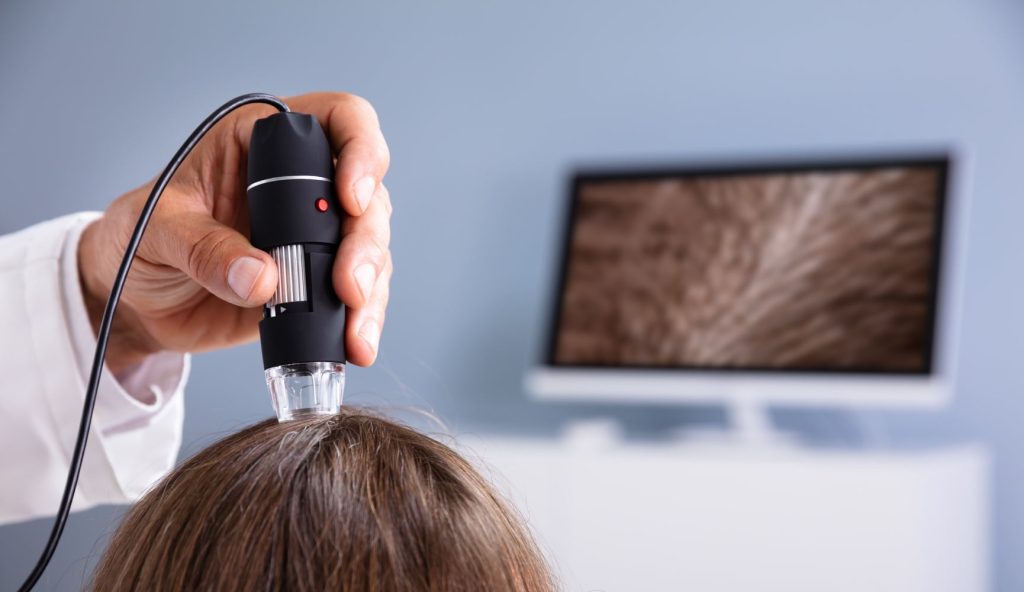How To Control, Treat And Prevent Super Lice In NJ!