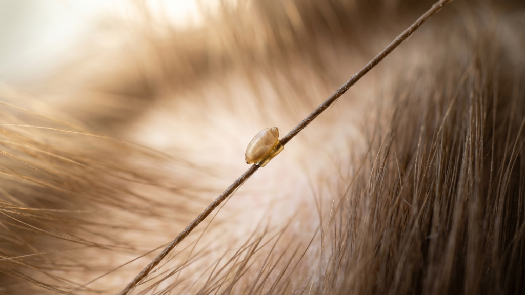 How Long Do Lice Eggs Take to Hatch?