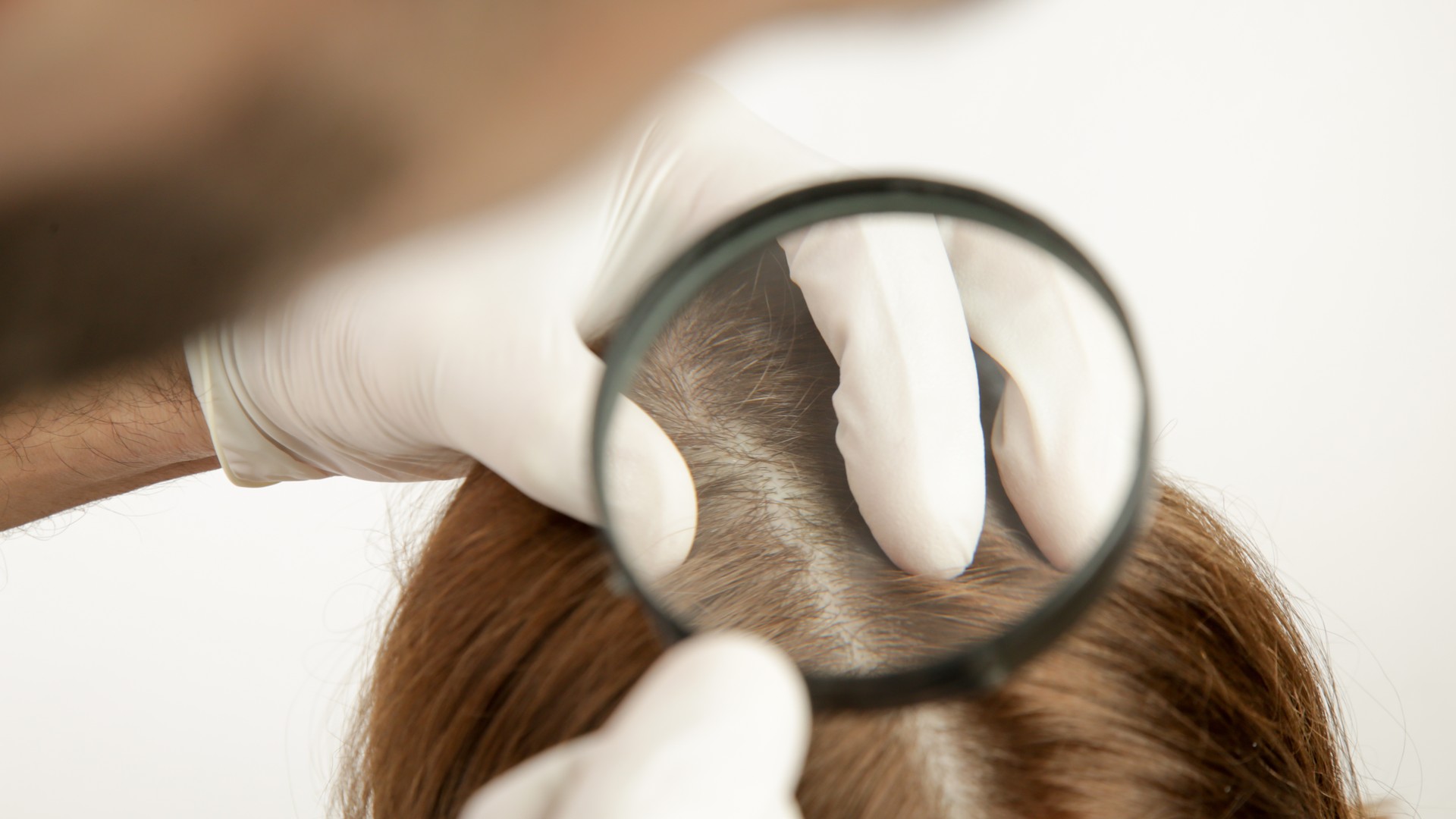 Professional examining hair for head lice across treatment stages