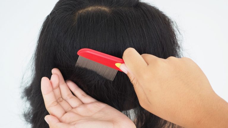 Do Head Lice Prefer Certain Blood Types?