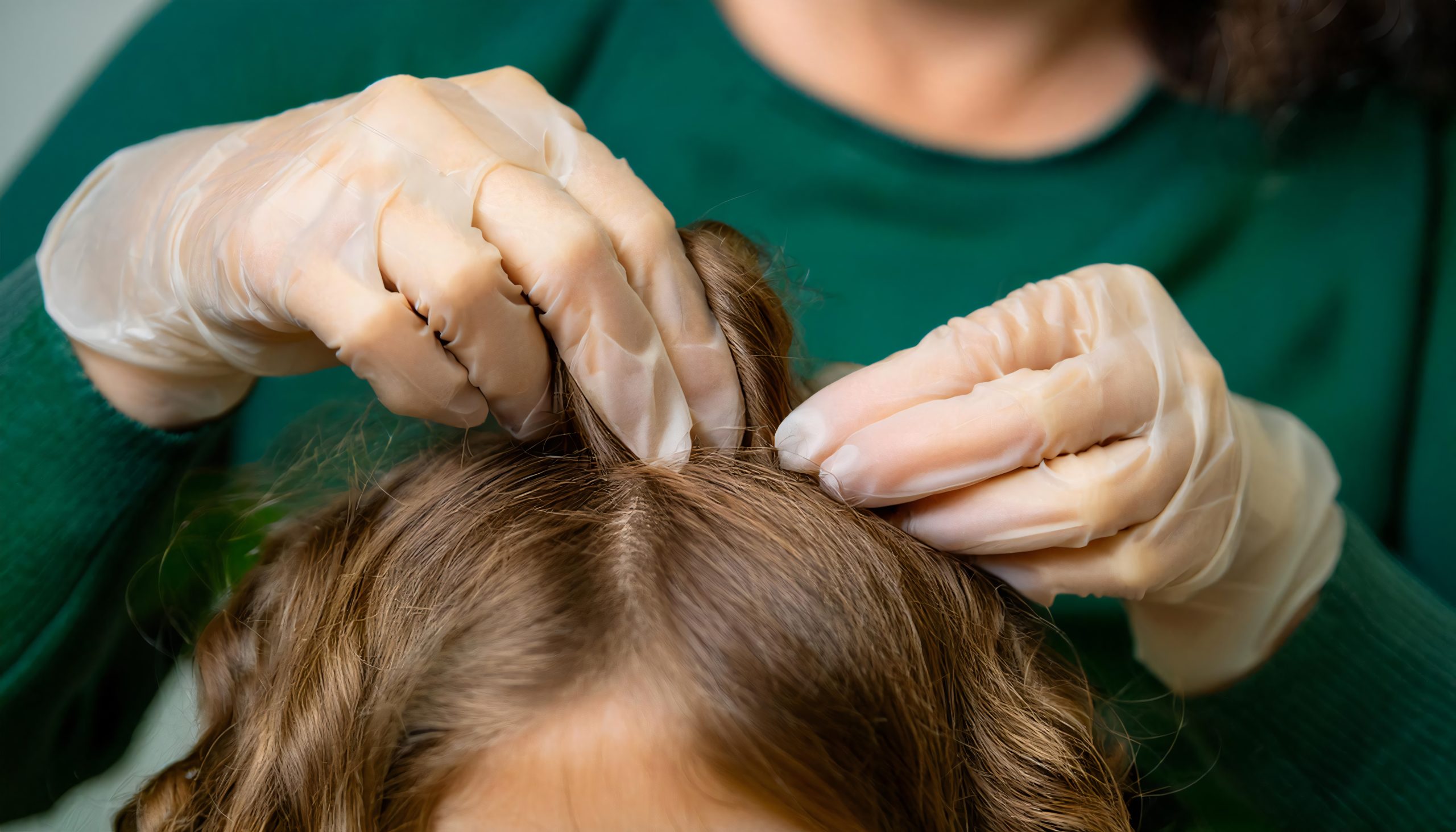 A mother parting and checking her daughter's hair for head lice, the kind of quick at-home head check that keeps a cheer or dance season from turning one case into a squad-wide outbreak