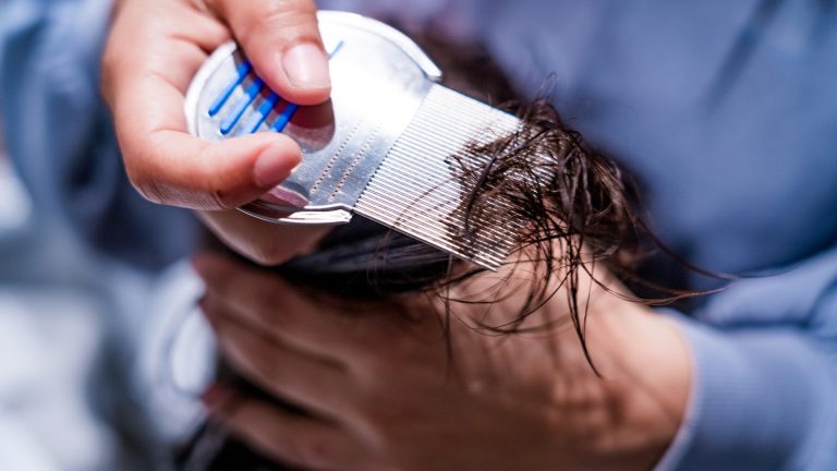 Why Cold Weather Won’t End Your Child’s Lice