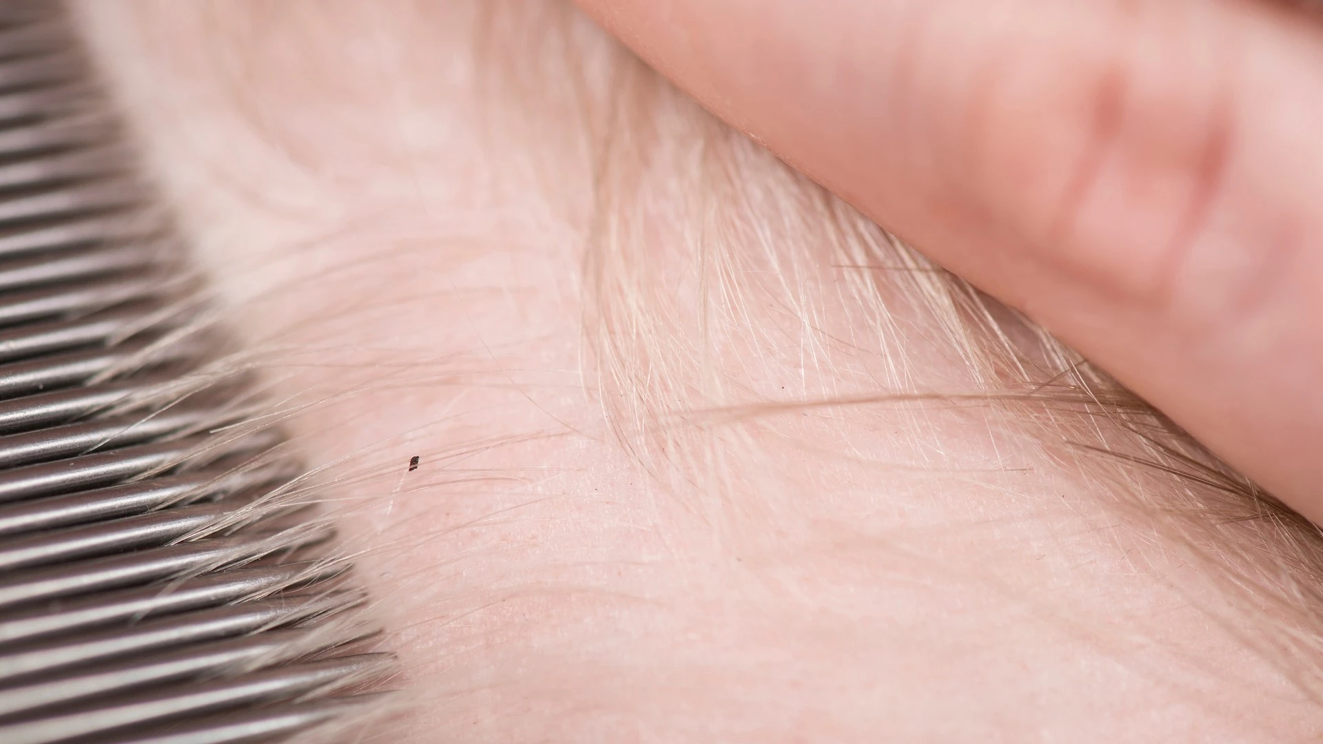 Metal fine-tooth comb and fingertip beside fine blonde hair at the scalp