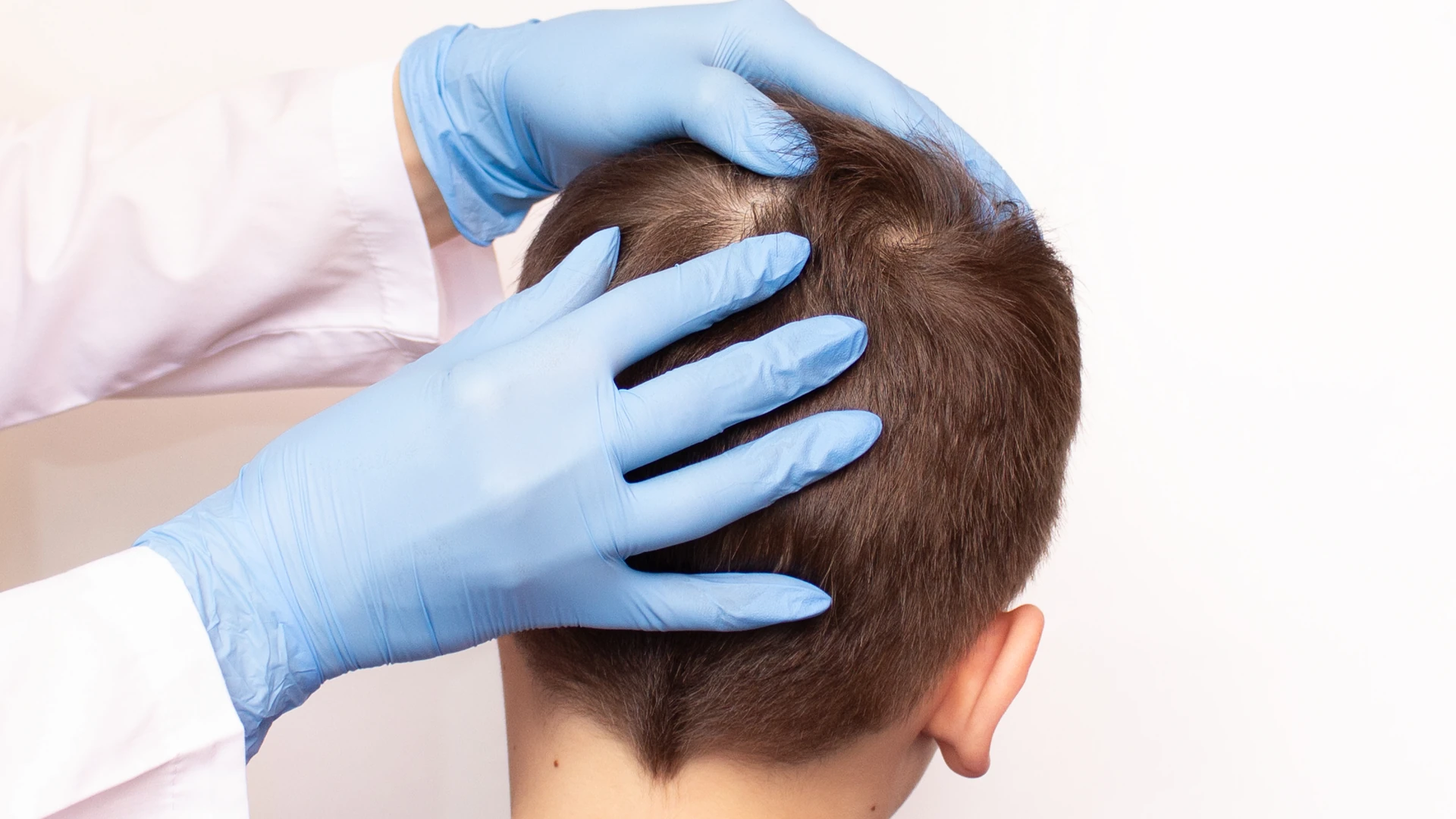 Blue-gloved hands parting short brown hair on the back of a head